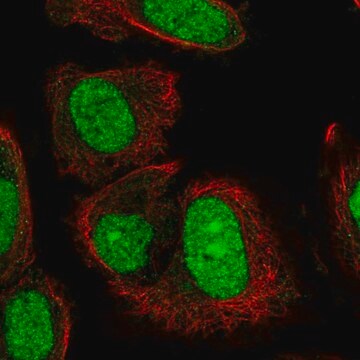 Anty-TRMT6 Prestige Antibodies&#174; Powered by Atlas Antibodies, affinity isolated antibody