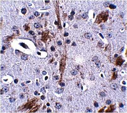 Anti-TTBK1 Antibody from rabbit, purified by affinity chromatography