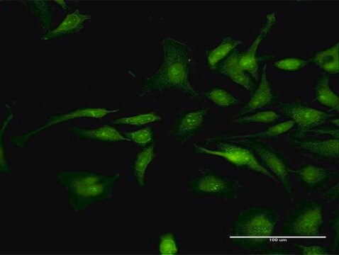 Anti-CTNND1 antibody produced in rabbit purified immunoglobulin, buffered aqueous solution