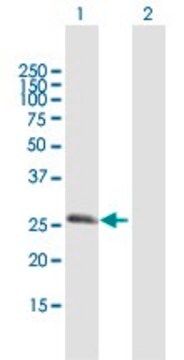 Anti-RGS20 antibody produced in mouse purified immunoglobulin, buffered aqueous solution