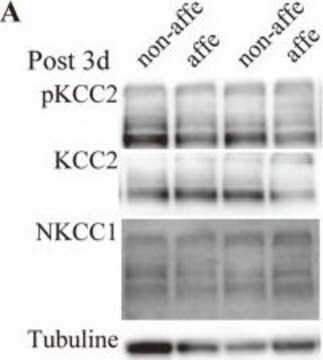 Anti-K+/Cl- Cotransporter (KCC2)-Antikörper Upstate&#174;, from rabbit