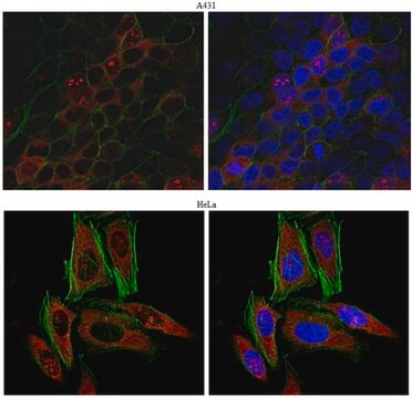 Anti-Kinectin Antibody from rabbit, purified by affinity chromatography