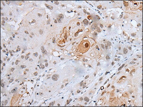 Anti-HOXC4 affinity isolated antibody