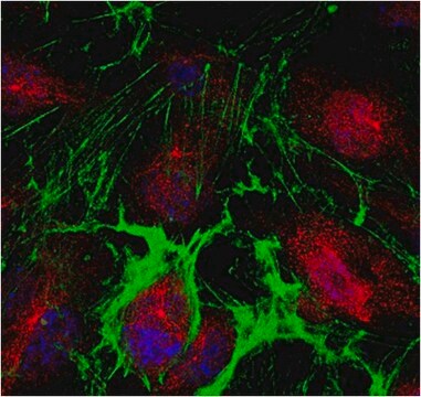 Anti-PPAR-gamma Antibody from rabbit, purified by affinity chromatography