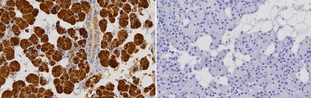 Anti-pan-Amylase Antibody, clone 3K13 ZooMAb&#174; Rabbit Monoclonal recombinant, expressed in HEK 293 cells