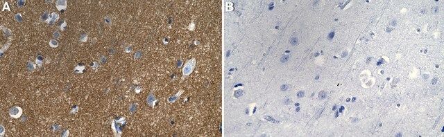 Anti-STXBP1/MUNC18-1 Antibody, clone 2K7 ZooMAb&#174; Rabbit Monoclonal recombinant, expressed in HEK 293 cells