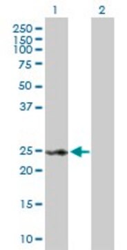 Anti-RAD54B antibody produced in rabbit purified immunoglobulin, buffered aqueous solution