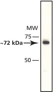 Anti-Histone Deacetylase 10 (HDAC10) antibody produced in rabbit affinity isolated antibody, buffered aqueous solution