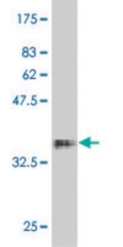 Monoclonal Anti-FKBP10 antibody produced in mouse clone 1C6, purified immunoglobulin, buffered aqueous solution