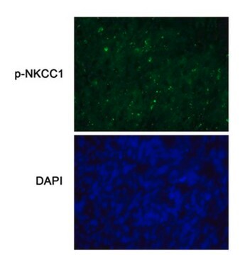 Anti-phospho-NKCC1-Antikörper (Thr212/Thr217) serum, from rabbit