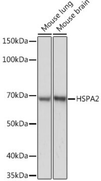 Anti-HSPA2 Antibody, clone 5C9X0, Rabbit Monoclonal