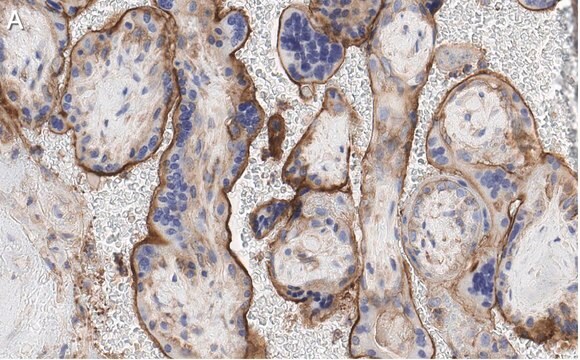 抗GNA-11（G&#945;11）抗体 クローン1F16 ZooMAb&#174;ウサギ・モノクローナル recombinant, expressed in HEK 293 cells