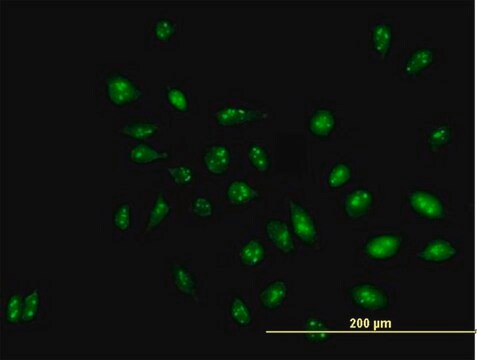 抗RRP1抗体 マウス宿主抗体 purified immunoglobulin, buffered aqueous solution