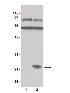 Rap1-Aktivierungsassay-Kit Non-radioactive Rap1 Activation Assay Kit that uses Ral GDS RBD, agarose (Catalog # 14-455) to precipitate Rap1-GTP from cell lysates &amp; detection by a Rap1 specific antibody.