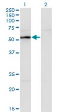 Monoclonal Anti-UAP1 antibody produced in mouse clone 3A9, purified immunoglobulin, buffered aqueous solution