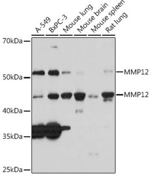 Anti-MMP12 Antibody, clone 1O3A4, Rabbit Monoclonal