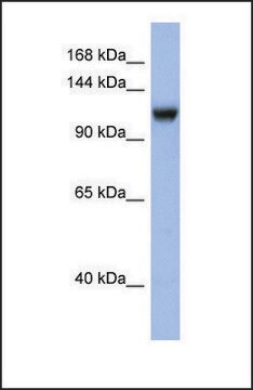 Anti-NR3C2, (N-terminal) antibody produced in rabbit affinity isolated antibody