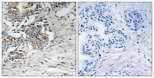 Anti-Claudin 7 antibody produced in rabbit affinity isolated antibody