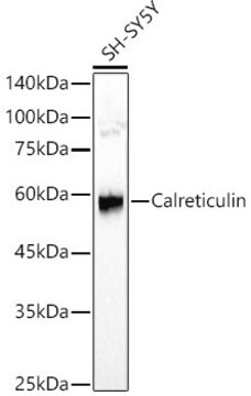 Anti-Calreticulin Antibody, clone 7T5B2, Rabbit Monoclonal