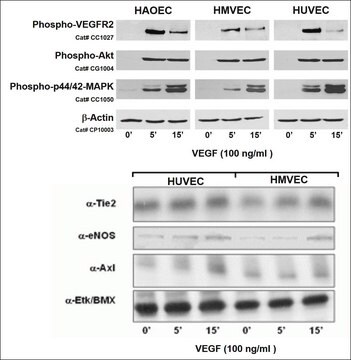 Human Dermal Microvascular Endothelial Cells: CADMEC/HMVEC: Pre-Screened for Angiogenesis &amp; VEGF signaling, neonatal