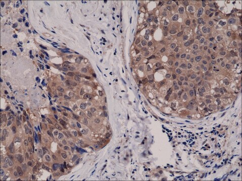 Anti-AKT1 antibody, Rabbit monoclonal recombinant, expressed in HEK 293 cells, clone RM252, purified immunoglobulin