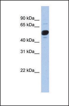 Anti-FRS3 antibody produced in rabbit affinity isolated antibody