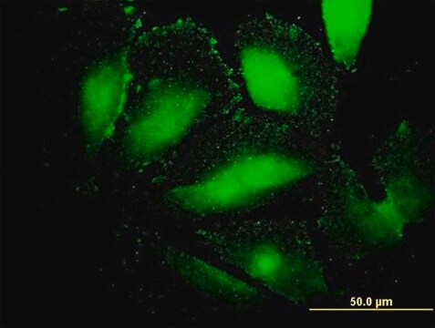 モノクロナール抗AFP マウス宿主抗体 clone 1G7, purified immunoglobulin, buffered aqueous solution