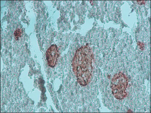 Anty-chromograninaA affinity isolated antibody