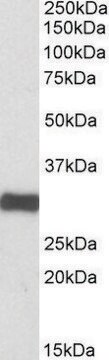 Anti-ETFA (C-terminal) antibody produced in goat affinity isolated antibody, buffered aqueous solution