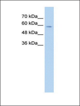 Anti-CES1 (AB2) antibody produced in rabbit IgG fraction of antiserum