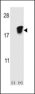 ANTI-SNRPD1 (CENTER) antibody produced in rabbit purified immunoglobulin, buffered aqueous solution