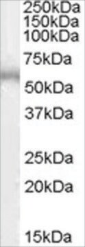 抗-ADRB1 山羊抗 affinity isolated antibody, buffered aqueous solution