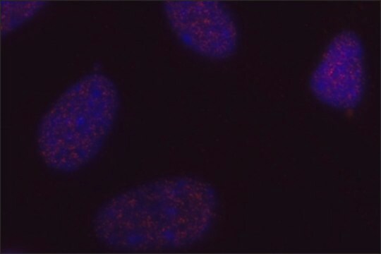 Anti-phospho-AKT (pThr450) antibody, Mouse monoclonal clone AK-11, purified from hybridoma cell culture