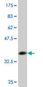 Monoclonal Anti-FCN1 antibody produced in mouse clone 2B7, purified immunoglobulin, buffered aqueous solution