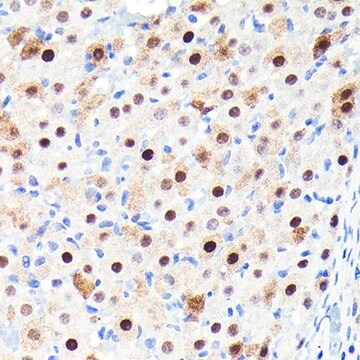 Anti- CDKN1B/p27KIP1 antibody produced in rabbit