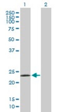 Anti-LYG2 antibody produced in mouse purified immunoglobulin, buffered aqueous solution