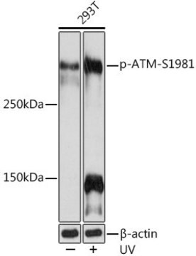 Anti-Phospho-ATM-S1981