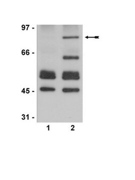 Anti-Acetyl-p53-Antikörper (Lys373, Lys382) serum, Upstate&#174;