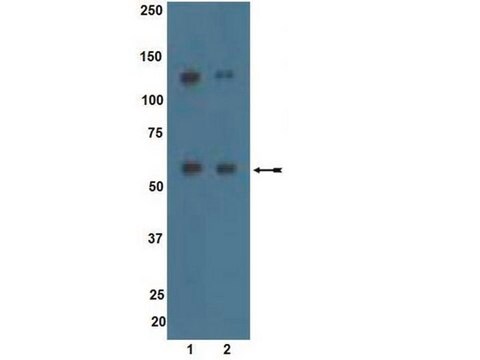 Anti-ALK7 Antibody Upstate&#174;, from rabbit