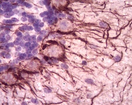 Anticuerpo anti-neurofilamento H (200&nbsp;kDa) from rabbit, purified by affinity chromatography