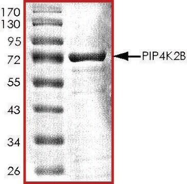 PIP4K2B, Active PRECISIO&#174; Kinase, recombinant