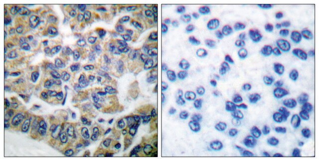 Anti-EEF2K antibody produced in rabbit affinity isolated antibody