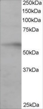 Anti-IRF6 antibody produced in goat affinity isolated antibody, buffered aqueous solution