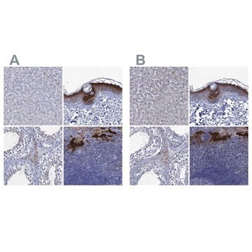 Anti-SCEL antibody produced in rabbit Prestige Antibodies&#174; Powered by Atlas Antibodies, affinity isolated antibody, buffered aqueous glycerol solution