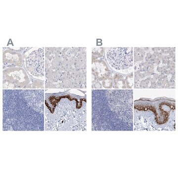 Anti-FRS3 antibody produced in rabbit Prestige Antibodies&#174; Powered by Atlas Antibodies, affinity isolated antibody, buffered aqueous glycerol solution, ab2