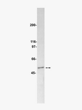 Anti-PP2A Antibody, B subunit, clone 2G9 ascites fluid, clone 2G9, Upstate&#174;