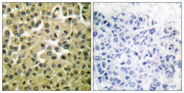 Anti-MCL1 antibody produced in rabbit affinity isolated antibody