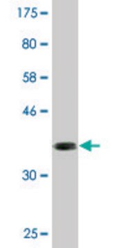 Monoclonal Anti-ABLIM1 antibody produced in mouse clone 2C6, purified immunoglobulin, buffered aqueous solution