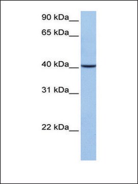 Anti-AGBL5 (AB1) antibody produced in rabbit affinity isolated antibody