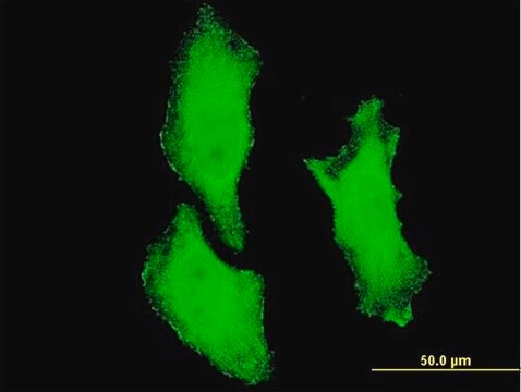 ANTI-CHUK antibody produced in mouse clone 4D11, purified immunoglobulin, buffered aqueous solution